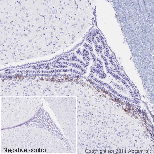 Immunohistochemistry (Formalin/PFA-fixed paraffin-embedded sections) - HRP Anti-Nestin antibody [rat-401] (AB196694), expandable thumbnail