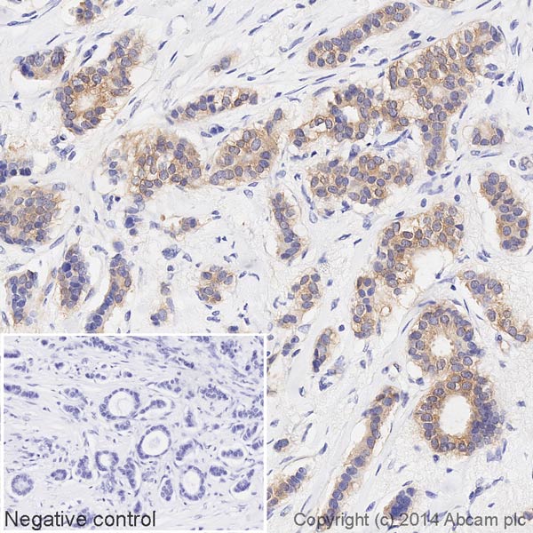 Immunohistochemistry (Formalin/PFA-fixed paraffin-embedded sections) - HRP Anti-NQO1 antibody [A180] (AB196629), expandable thumbnail