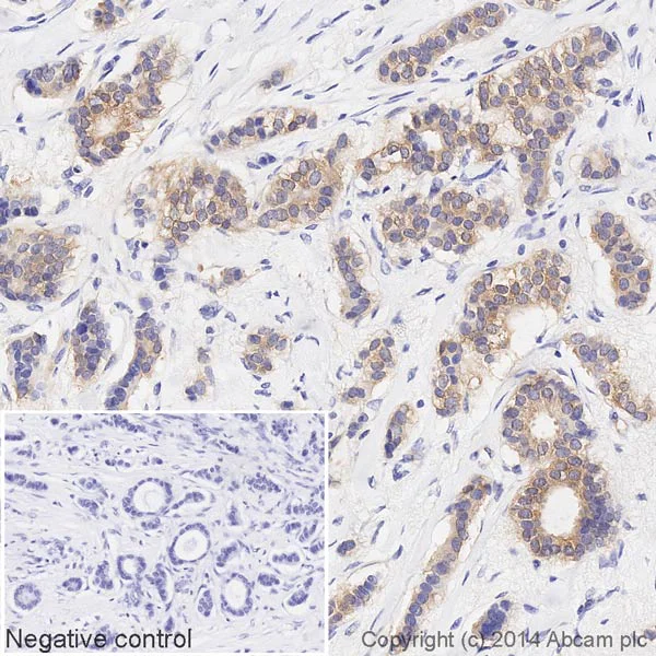 Immunohistochemistry (Formalin/PFA-fixed paraffin-embedded sections) - HRP Anti-NQO1 antibody [A180] (AB196629)