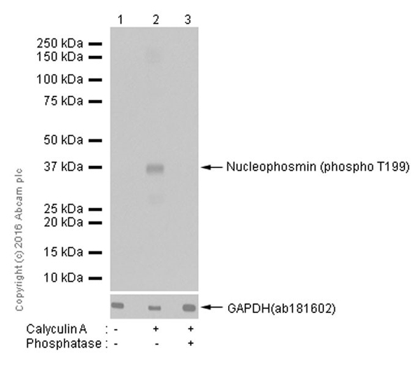 Western blot - HRP Anti-Nucleophosmin (phospho T199) antibody [EP1857Y] (AB202879)