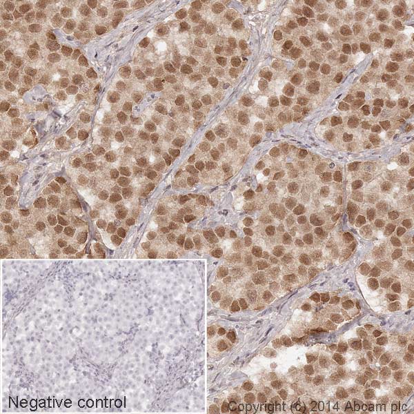 Immunohistochemistry (Formalin/PFA-fixed paraffin-embedded sections) - HRP Anti-Oct4 antibody [EPR2054] (AB194076), expandable thumbnail