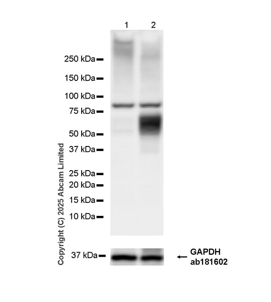 Western blot - HRP Anti-Osteopontin antibody [EPR21139-316] (AB324174), expandable thumbnail