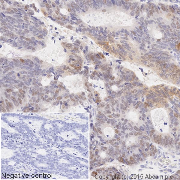Immunohistochemistry (Formalin/PFA-fixed paraffin-embedded sections) - HRP Anti-p53 (phospho S46) antibody [EP42Y] (AB202864), expandable thumbnail