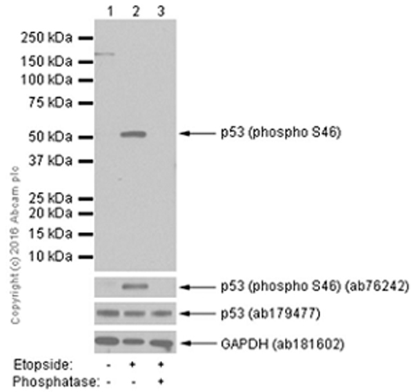 Western blot - HRP Anti-p53 (phospho S46) antibody [EP42Y] (AB202864), expandable thumbnail