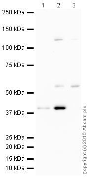 Western blot - HRP Anti-p53R2 antibody [EPR8816] (AB206095), expandable thumbnail