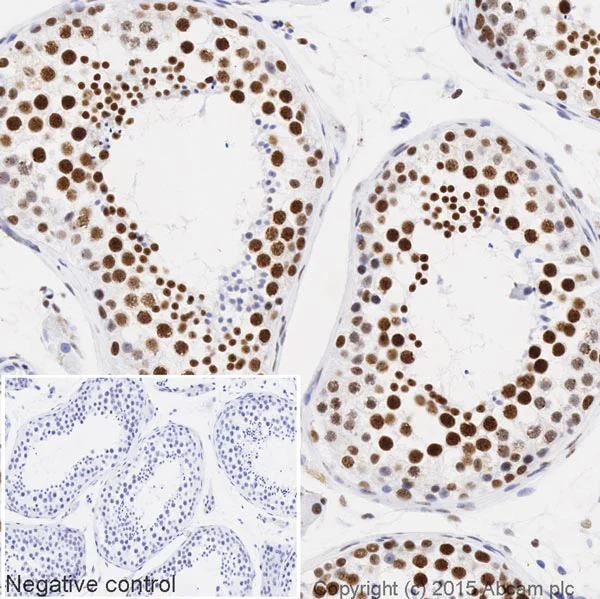 Immunohistochemistry (Formalin/PFA-fixed paraffin-embedded sections) - HRP Anti-PABPN1 antibody [EP3000Y] (AB207515)