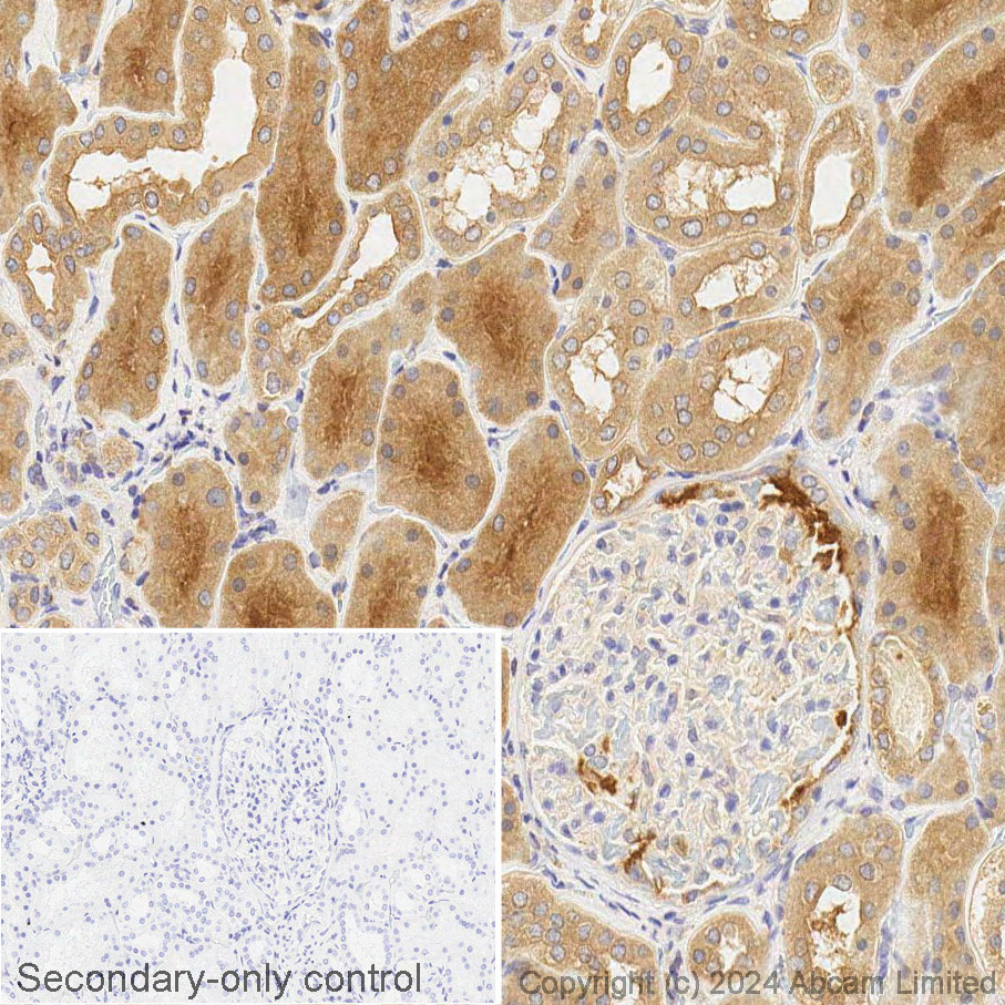 Immunohistochemistry (Formalin/PFA-fixed paraffin-embedded sections) - HRP Anti-PAH antibody [EPR12380] (AB303094), expandable thumbnail