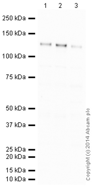 Western blot - HRP Anti-pan Cadherin antibody [mAbcam22744] (AB197725), expandable thumbnail