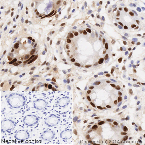 Immunohistochemistry (Formalin/PFA-fixed paraffin-embedded sections) - HRP Anti-PCNA antibody [EPR3821] (AB193965)