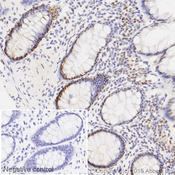 Immunohistochemistry (Formalin/PFA-fixed paraffin-embedded sections) - HRP Anti-PCNA antibody [PC10] (AB201673)