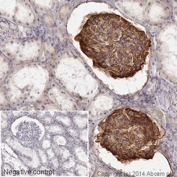 Immunohistochemistry (Formalin/PFA-fixed paraffin-embedded sections) - HRP Anti-PDGFR alpha + PDGFR beta antibody [Y92] (AB195515), expandable thumbnail