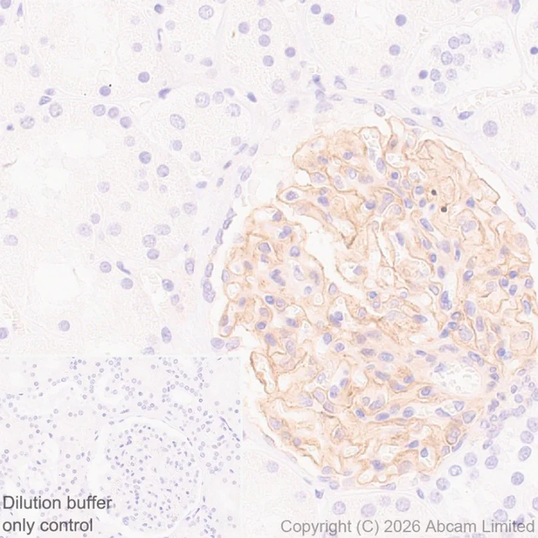 Immunohistochemistry (Formalin/PFA-fixed paraffin-embedded sections) - HRP Anti-PDGFR alpha + PDGFR beta antibody [Y92] (AB195515)