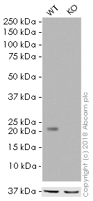 Western blot - HRP Anti-Peroxiredoxin 2/PRP antibody [EPR5154] (AB197042), expandable thumbnail