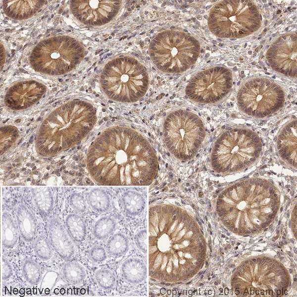 Immunohistochemistry (Formalin/PFA-fixed paraffin-embedded sections) - HRP Anti-PGK1 antibody [22C5D8] (AB197960)