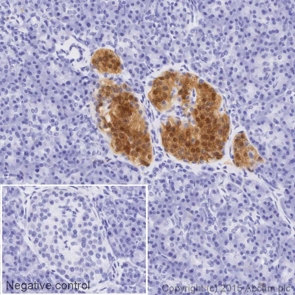 Immunohistochemistry (Formalin/PFA-fixed paraffin-embedded sections) - HRP Anti-PGP9.5 antibody [13C4 / I3C4] - Neuronal Marker (AB197735)