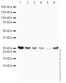 Western blot - HRP Anti-PGP9.5 antibody [13C4 / I3C4] - Neuronal Marker (AB197735)