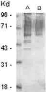 Western blot - HRP Anti-Phosphothreonine antibody (AB9338)