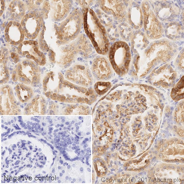 Immunohistochemistry (Formalin/PFA-fixed paraffin-embedded sections) - HRP Anti-PKC alpha antibody [Y124] (AB205422)