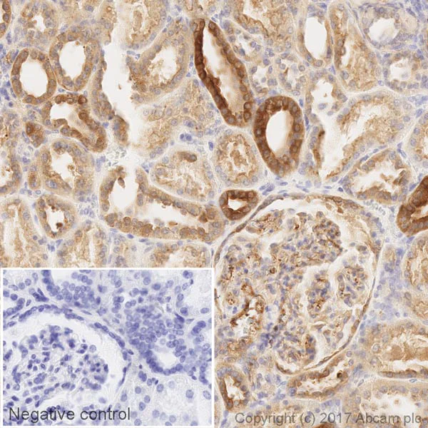 Immunohistochemistry (Formalin/PFA-fixed paraffin-embedded sections) - HRP Anti-PKC alpha antibody [Y124] (AB205422)