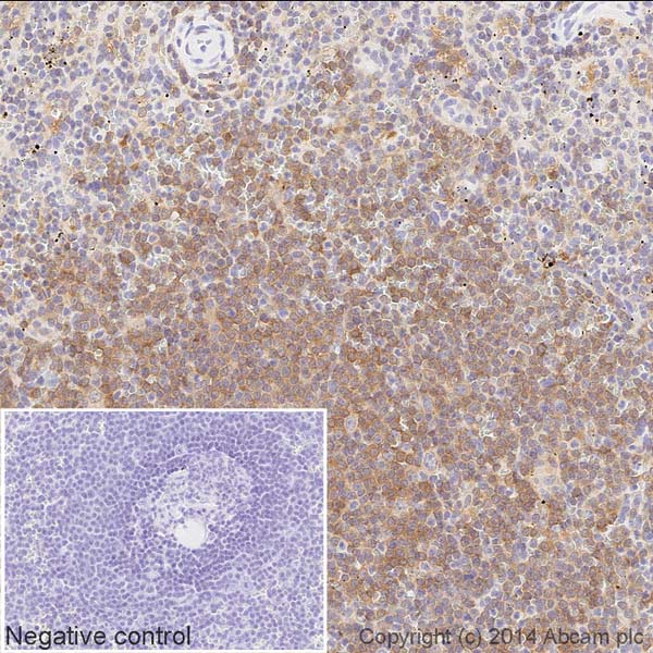 Immunohistochemistry (Formalin/PFA-fixed paraffin-embedded sections) - HRP Anti-PKC beta 2 antibody [Y125] (AB194906), expandable thumbnail