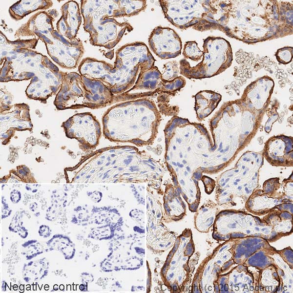 Immunohistochemistry (Formalin/PFA-fixed paraffin-embedded sections) - HRP Anti-Placental alkaline phosphatase (PLAP) antibody [EPR6141] (AB198554), expandable thumbnail