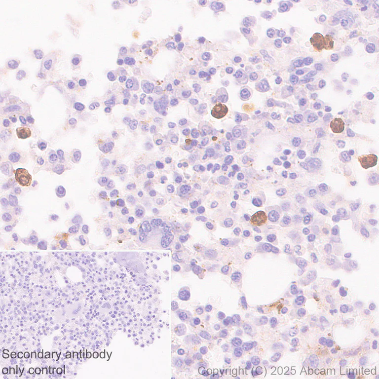 Immunohistochemistry (Formalin/PFA-fixed paraffin-embedded sections) - HRP Anti-PRG2 antibody [EPR29096-502] (AB324154)