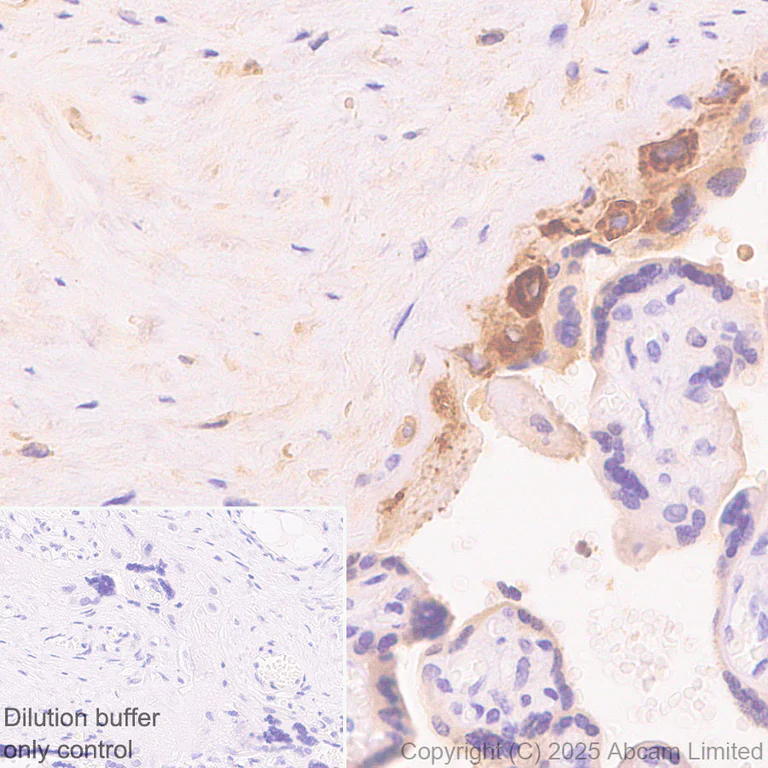Immunohistochemistry (Formalin/PFA-fixed paraffin-embedded sections) - HRP Anti-PRG2 antibody [EPR29096-502] (AB324154)