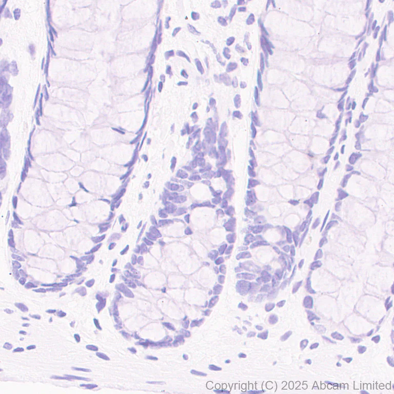 Immunohistochemistry (Formalin/PFA-fixed paraffin-embedded sections) - HRP Anti-PRG2 antibody [EPR29096-502] (AB324154)