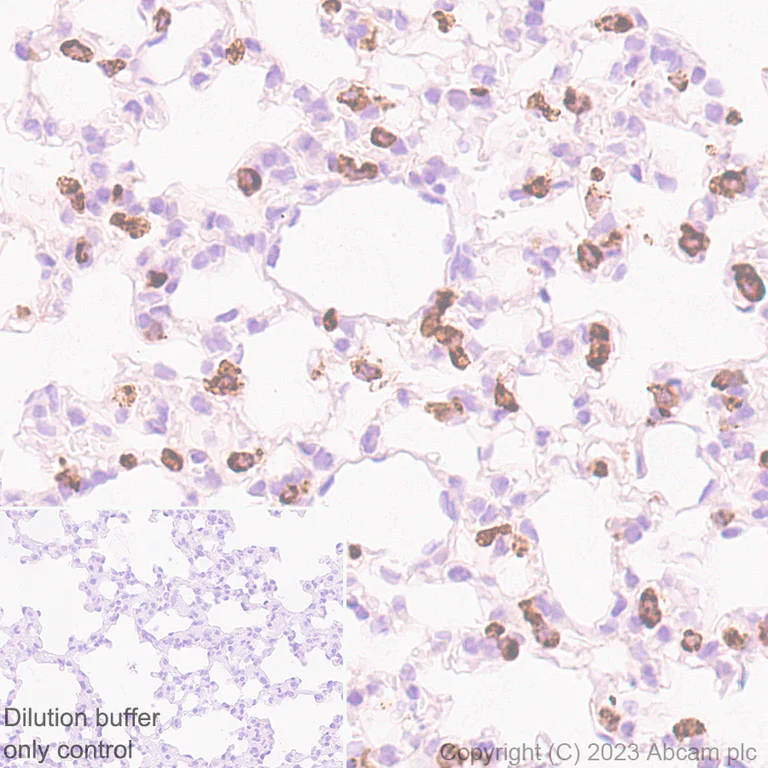Immunohistochemistry (Formalin/PFA-fixed paraffin-embedded sections) - HRP Anti-Prosurfactant Protein C antibody [EPR19839] (AB314245)