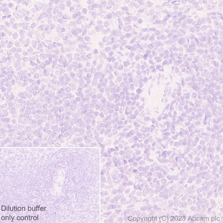 Immunohistochemistry (Formalin/PFA-fixed paraffin-embedded sections) - HRP Anti-Prosurfactant Protein C antibody [EPR19839] (AB314245)