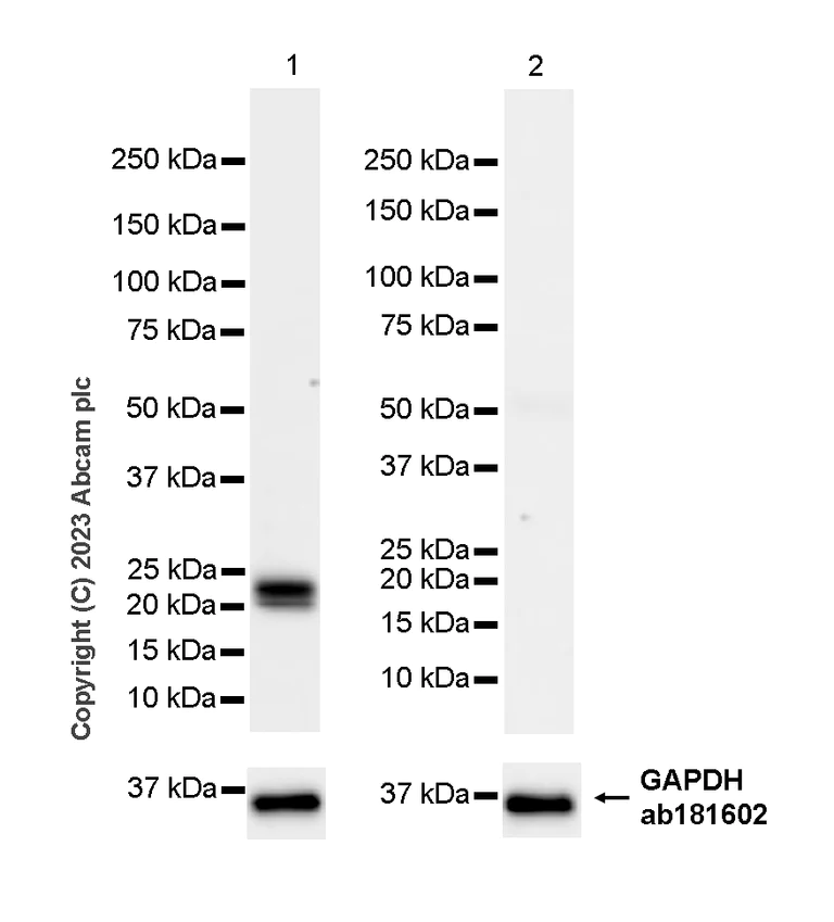 Western blot - HRP Anti-Prosurfactant Protein C antibody [EPR19839] (AB314245)