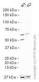 Western blot - HRP Anti-PTEN antibody [Y184] (AB199545), expandable thumbnail
