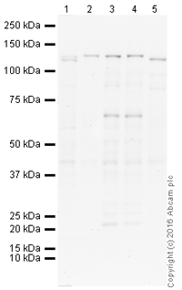 Western blot - HRP Anti-PYK2 antibody [YE353] (AB214497)