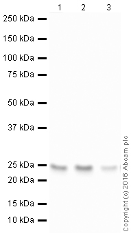 Western blot - HRP Anti-Rab5 antibody [EPR17321] (AB209475), expandable thumbnail