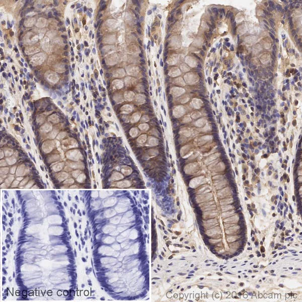 Immunohistochemistry (Formalin/PFA-fixed paraffin-embedded sections) - HRP Anti-RAB8A antibody [EPR14873] - C-terminal (AB209046)
