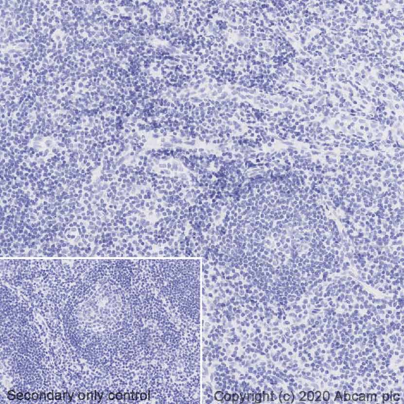 Immunohistochemistry (Formalin/PFA-fixed paraffin-embedded sections) - HRP Anti-Rabbit IgG antibody [SP137] (AB270144)