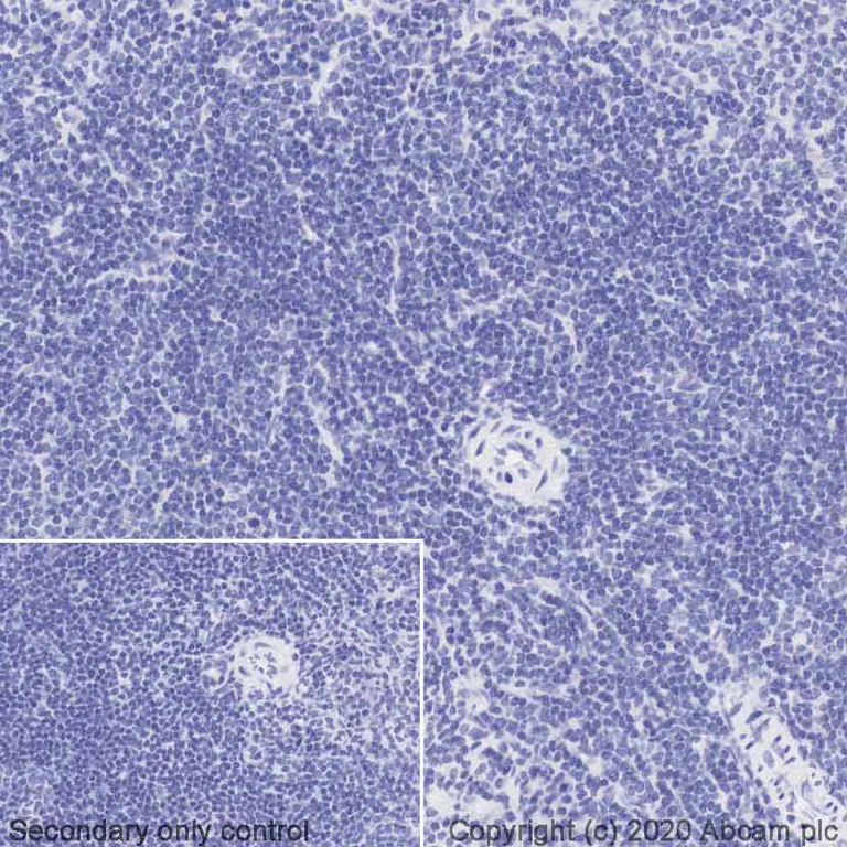 Immunohistochemistry (Formalin/PFA-fixed paraffin-embedded sections) - HRP Anti-Rabbit IgG antibody [SP137] (AB270144)