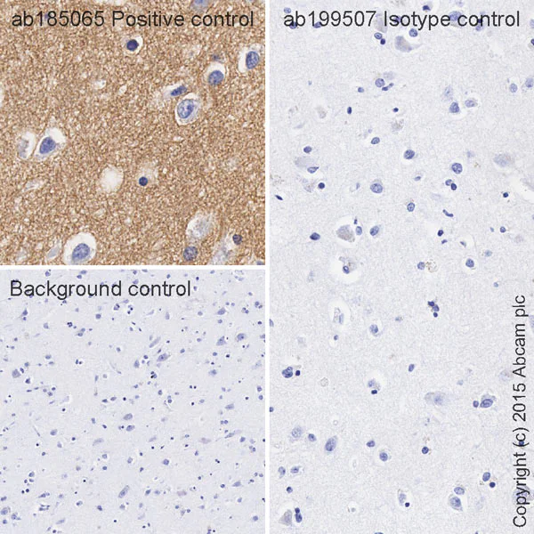Immunohistochemistry (Formalin/PFA-fixed paraffin-embedded sections) - HRP Rabbit IgG, monoclonal [EPR25A] - Isotype Control (AB199507)