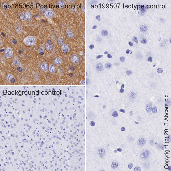 Immunohistochemistry (Formalin/PFA-fixed paraffin-embedded sections) - HRP Rabbit IgG, monoclonal [EPR25A] - Isotype Control (AB199507)