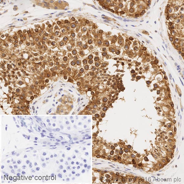 Immunohistochemistry (Formalin/PFA-fixed paraffin-embedded sections) - HRP Anti-RanGAP1 antibody [EPR3295] (AB205449)