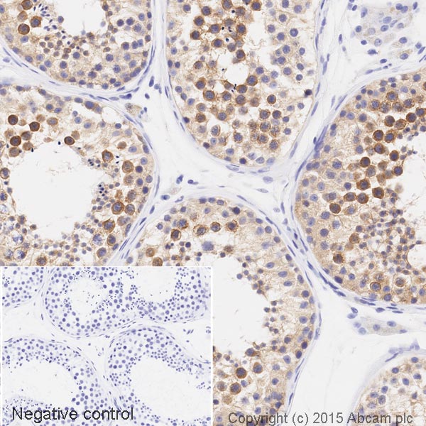 Immunohistochemistry (Formalin/PFA-fixed paraffin-embedded sections) - HRP Anti-RENT1/hUPF1 antibody [EPR4681] (AB201818), expandable thumbnail