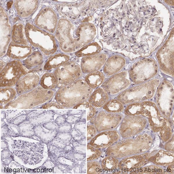 Immunohistochemistry (Formalin/PFA-fixed paraffin-embedded sections) - HRP Anti-Retinoic Acid Receptor beta antibody [EPR2017] (AB198557)