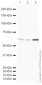 Western blot - HRP Anti-Retinoic Acid Receptor beta antibody [EPR2017] (AB198557)