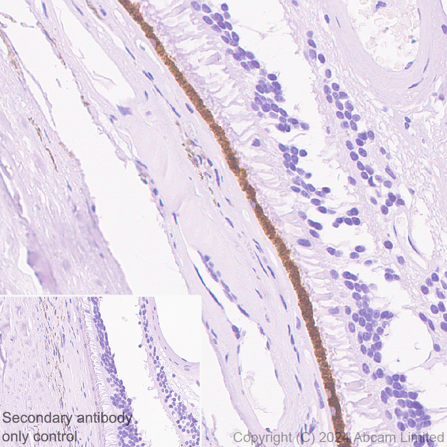Immunohistochemistry (Formalin/PFA-fixed paraffin-embedded sections) - HRP Anti-RPE65 antibody [EPR22579-44] (AB324030), expandable thumbnail