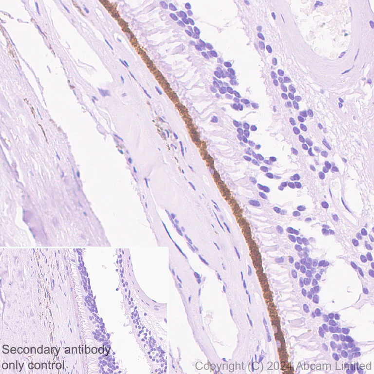 Immunohistochemistry (Formalin/PFA-fixed paraffin-embedded sections) - HRP Anti-RPE65 antibody [EPR22579-44] (AB324030)