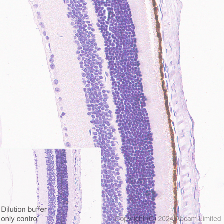 Immunohistochemistry (Formalin/PFA-fixed paraffin-embedded sections) - HRP Anti-RPE65 antibody [EPR22579-44] (AB324030), expandable thumbnail
