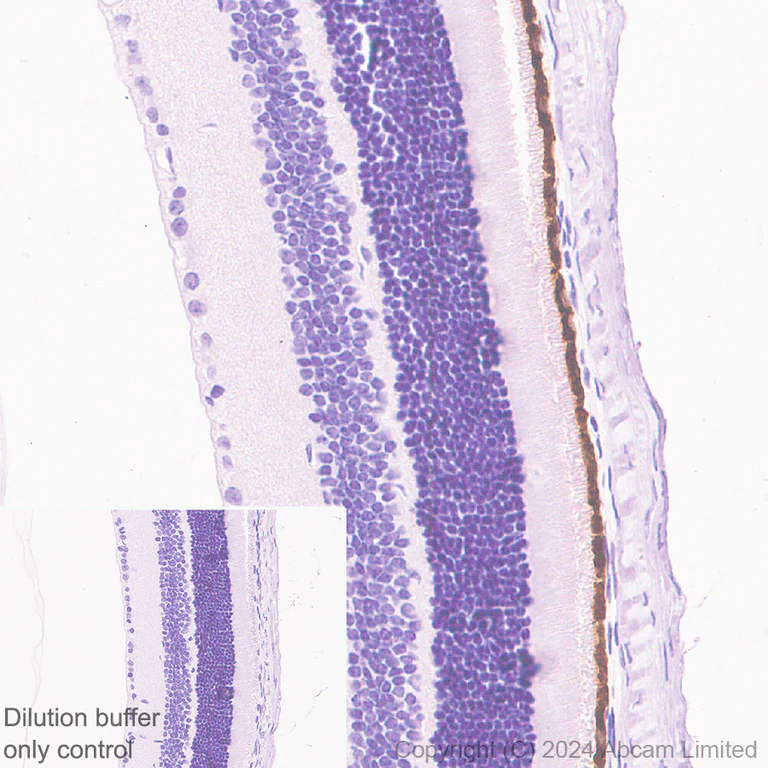 Immunohistochemistry (Formalin/PFA-fixed paraffin-embedded sections) - HRP Anti-RPE65 antibody [EPR22579-44] (AB324030)
