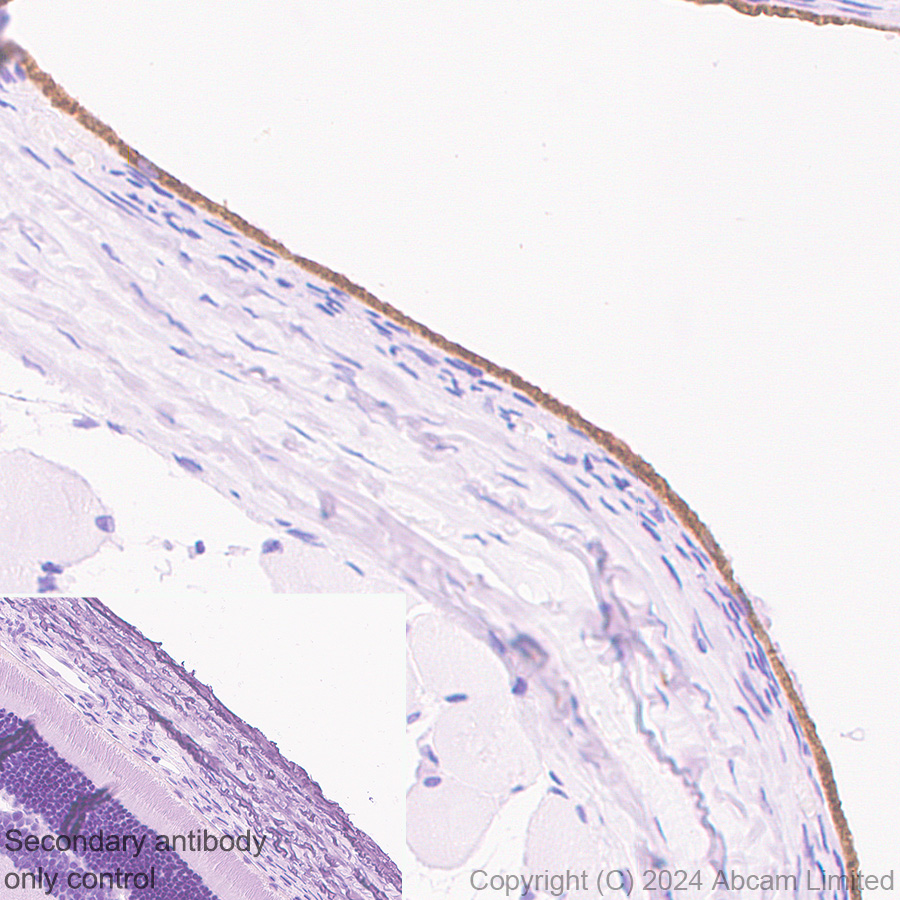 Immunohistochemistry (Formalin/PFA-fixed paraffin-embedded sections) - HRP Anti-RPE65 antibody [EPR22579-44] (AB324030), expandable thumbnail