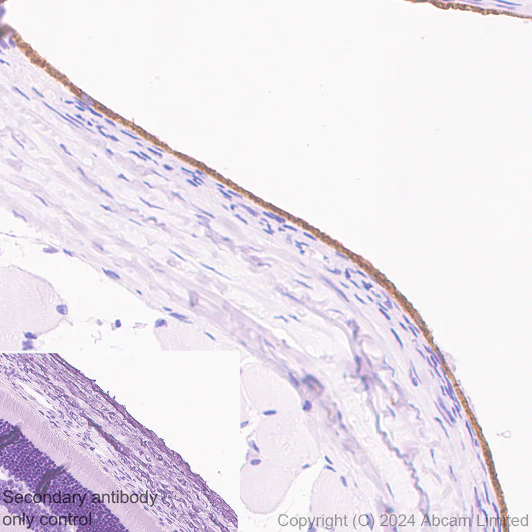 Immunohistochemistry (Formalin/PFA-fixed paraffin-embedded sections) - HRP Anti-RPE65 antibody [EPR22579-44] (AB324030)