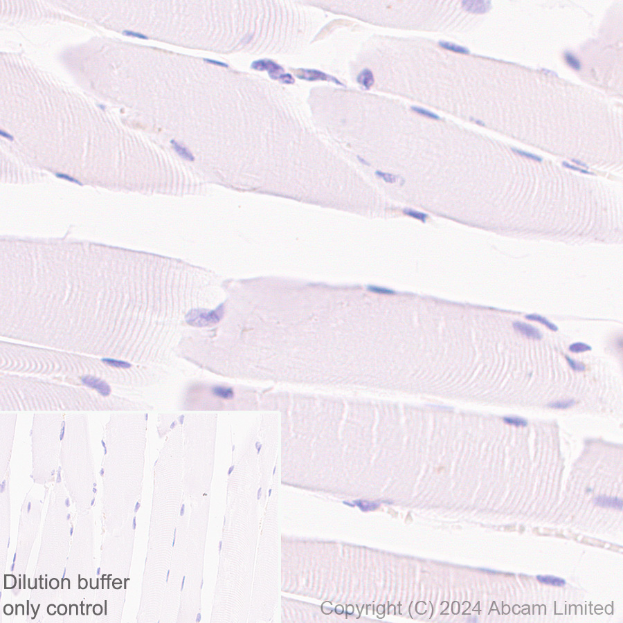Immunohistochemistry (Formalin/PFA-fixed paraffin-embedded sections) - HRP Anti-RPE65 antibody [EPR22579-44] (AB324030), expandable thumbnail